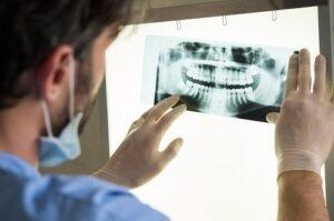 male dentist examining x-ray