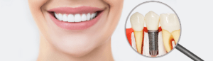 close up of a person's smile