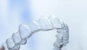 clear dental aligners
