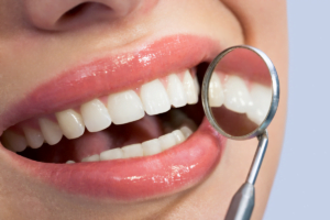 Give Yourself The Gift Of Dental Veneers