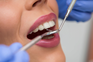 What Sets Apart Basic and Major Dental Care Services?