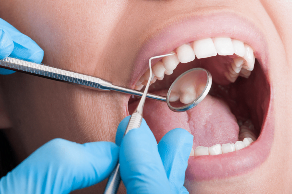 Root Canal Treatment Guide