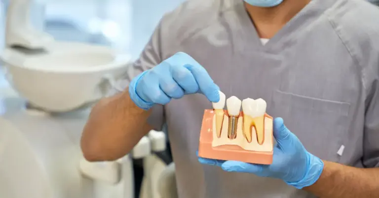 Dental Implants Cost: What You Should Know