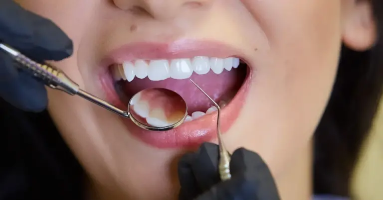 Top 10 Dental Procedures & Their Function